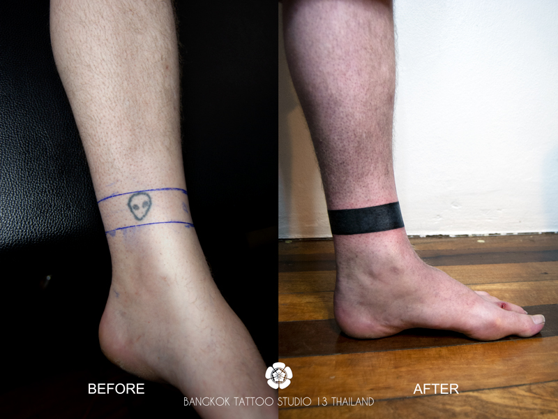cover-up-band-ring-black-ink-tattoo-thailand