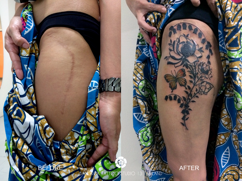 cover-up-old-scare-flower-tattoo-bangkok